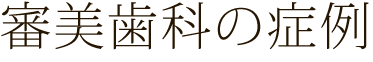 審美歯科・当院の症例